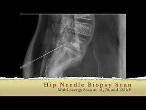 X-Ray Material Decomposition