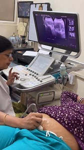 Early pregnancy around 4 weeks can not be diagnosed on routine ultrasound but TVS can confirm 4 weeks pregnancy 💯 🤰 #Transvaginalsonography #early pregnancy #pregnancytips #pregnancytime #gestationalsac | Dr home - Dr shikha Agarwal