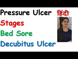 Pressure Ulcer | Stages of Pressure Ulcer | Bed Sores | Decubitus Ulcer | RajNEET Medical Education