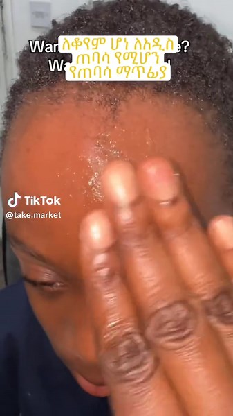 clear beauty #acne #scar #removal #viral #ethiopian_tik_tok🇪🇹🇪🇹🇪🇹🇪🇹