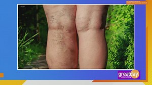 Treat poor circulation and get moving again!