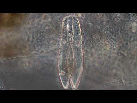 Paramecium conjugation - Protozoans and other small critters