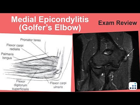 Medial Epicondylitis (Golfer's Elbow) Exam Review - Christopher S. Ahmad, MD