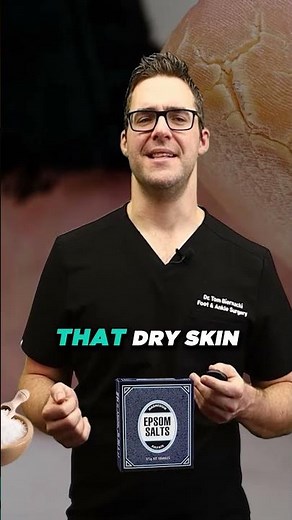 How To Get Rid Of Corns? [Top Corn Home Remedies, Simple Self Care Treatments! Inexpensive! ]