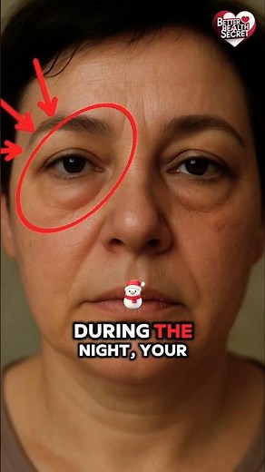 Why Does Your Face Look Puffy in the Morning? #betterhealthsecrets