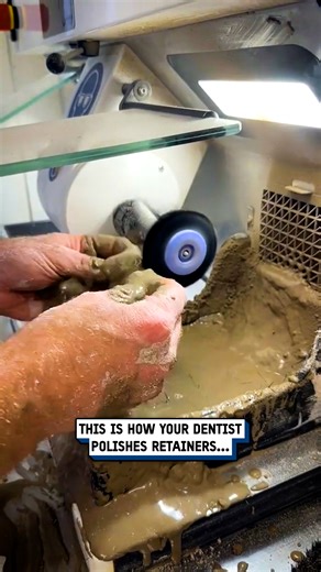815K views · 780 reactions | I never knew they used mud to polish retainers 勞藍 #retainer #teeth #dentist | UNILAD Tech | Facebook