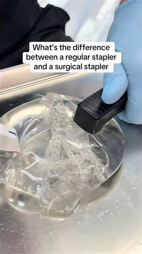 How This Stapler Changed Surgery Forever! 🤯