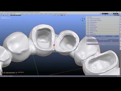 🦷 iBar 2.0 analyze your mesh to avoid errors