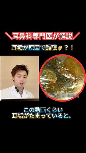 Can earwax cause hearing loss? An ENT doctor explains | Why earwax impaction impairs hearing [Min...