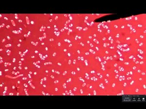 Lab 3-9: Capsule Stain Technique