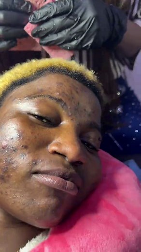 We offer premium skin and Body services for both Men and Women 🔥🔥 #viraltiktok #camerountiktok🇨🇲 #foryoupage❤️❤️ #tiktoknigeria🇳🇬 #worworgirl #celebrityaesthetician #tiktokcameroon🇨🇲tiktokafrica @Pranksters_kavo🇨🇲 🇳🇬🇿🇦