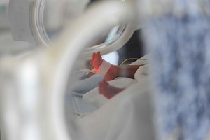 Botallo's ductus arteriosus: interventional therapy | Emergency Live