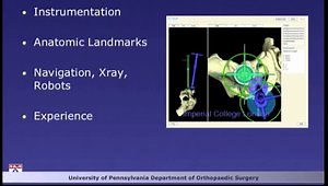 Acetabular Preparation and Cup Positioning in Primary THA