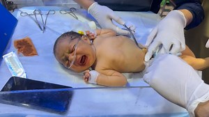 How to Insert UVC in Neonates | Umbilical Venous Catheter Placement in NICU - Step by Step Guide” #newbornbaby #nicucare #CuteBaby #neonatologist | Anoop Gautam