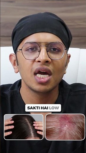 Derma Roller for HAIR REGROWTH | Risks and Side Effects You Need to Know | Hair fall solution