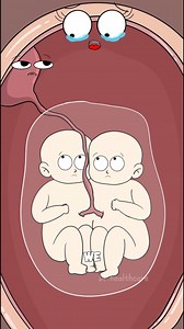 How Do Conjoined Twins Form? | Dr. Healthcare