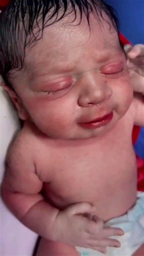 13K views · 353 reactions | This video shows a precious NICU baby crying during care — a reminder of how strong these little fighters truly are.  Every cry tells a story of courage, healing, and hope. Watch till the end to see how love and care make a difference. #NICU #NewbornCare #BabyCry #NICULife #TinyFighter #NurseLife #NewbornBaby #BabyCare #MiracleBaby #HospitalCare #NeonatalCare | pediatrician019 | Facebook