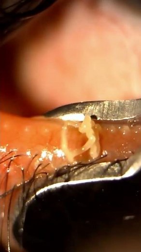 Satisfying stye pop