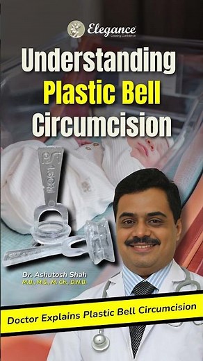Ever heard about Plastic Bell Circumcision #circumcision #penilehealth #menshealth #menssexualhealth