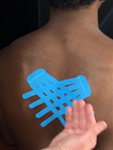 Taping For Lower Trap Activation. Commennt