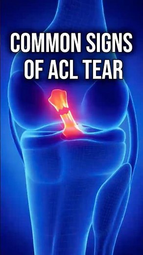 5 Common ACL Tear Signs to Know