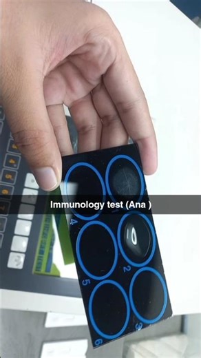 ANA test detects antibodies that attack the cell nucleus, helping identify autoimmune diseases