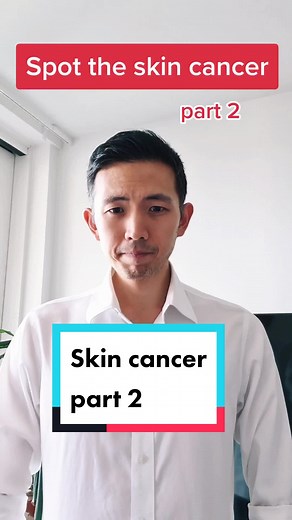 Understanding Nail Melanoma: Symptoms, Treatment, and Prevention