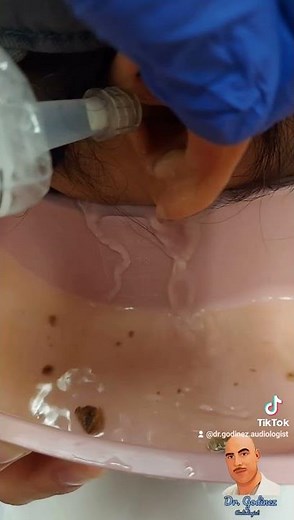 Ear cleaning (This is how we do it)