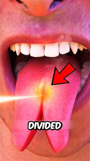 How People Split Their Tongue (Extreme Body Modification Explained)