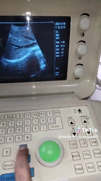 use portable Ultrasound Machine contact: 0305-4766804 #medline #medicalstudent #ultrasound #midwife #lhv #radiologist #gynocologist