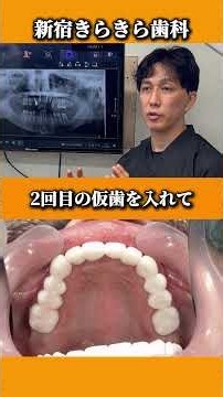 【激変】前歯がない状態から理想の歯へ #歯がボロボロ #セラミック治療 #インプラント