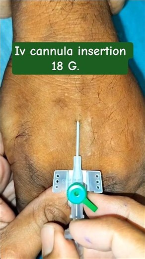 The Perfect 18G IV Flashback! 💉🩸 #IVcannula #nursingskills #shorts