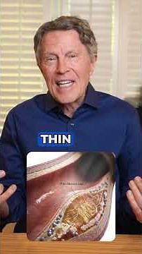 Soft Plaque vs Hard Plaque: Why the Difference Matters