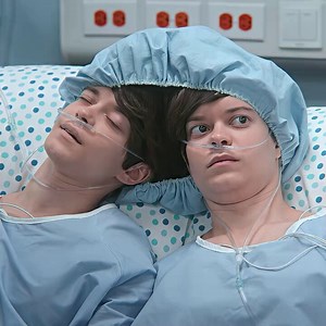 These conjoined twins are about to undergo a separation surgery but one of them changed their mind What the other twin did shocked everyone