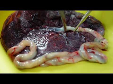 Novel Model Employing the Placenta for Pelvic Dissection