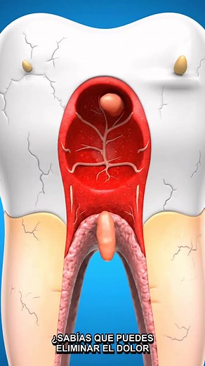 Cómo quitar el dolor de muela en 5 minutos: ¡Truco efectivo!