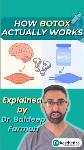 How Botox Works Explained | What Really Happens When You Get Anti-Wrinkle Injections