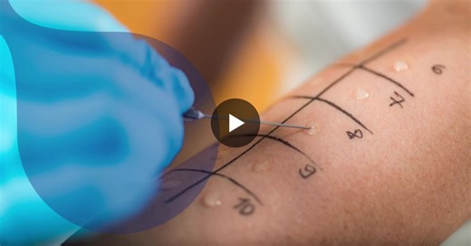 Skin Prick Testing for Medical Devices: FDA Compliance and Safety Assurance | Eurofins Cosmetics and Personal Care NA posted on the topic | LinkedIn