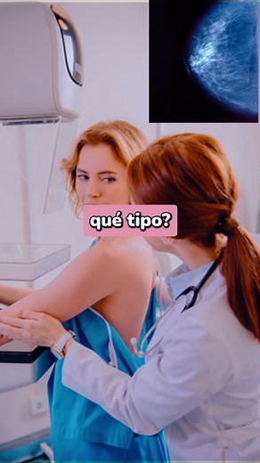 ¿Qué significa el tipo de Bi-Rads en mis estudios?