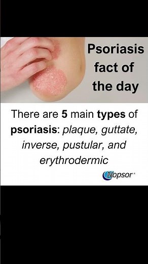 Understanding Psoriasis: Types of Psoriasis