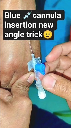 Cannula Insertion 💉 | Perfect Blood Flashback 🩸🔥 #Shorts #mhbmedico #doctor #nurse
