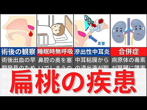 [Explanation in 4 minutes, national exam questions in 9 minutes] Explaining tonsillitis and tonsi...