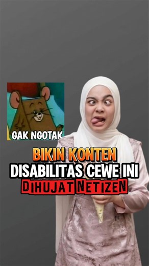 This Woman Created Content Pretending to Have a Disability, She Was Finally Criticized