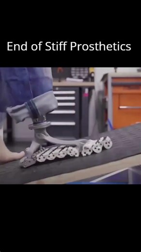 The End of Stiff Prosthetics? Meet the SoftFoot Pro!