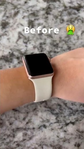 The most comfortable Apple Watch band you'll ever wear