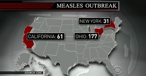 CDC: U.S. measles cases reach 20-year high