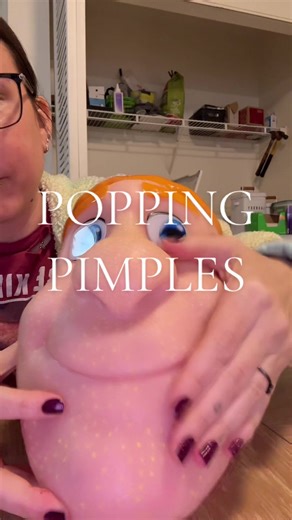 PIMPLE POPPING!! #pimplepopping #fyp #satisfying #asmr | pimple popper