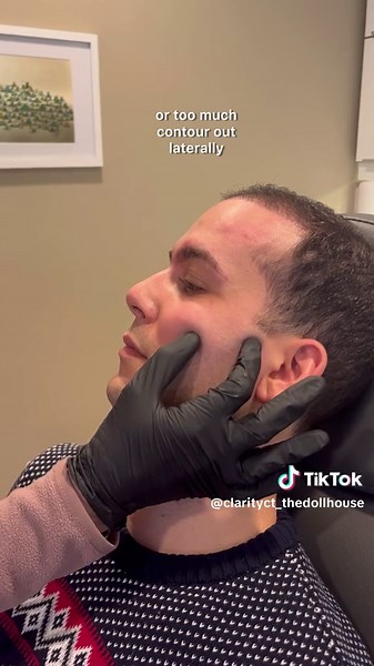 Male anatomy ages differently than female anatomy. Filler placement is everything! 💉 #cheekbones #filler #injectables #cheekbonecontour #maleanatomy #maleface #injectablesareforall #laughlines #wrinkles #projection #restylane