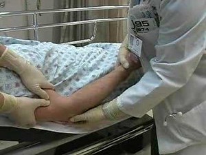 Dislocation Reduction Elbow (sample) - proceduresconsult.com