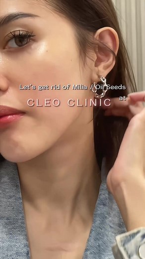 Effective Milia Removal at CLEO Aesthetic & Skin Clinic